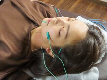 ウェル 姶良店(WELL)/美容鍼