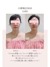 トゥインクル 麻布(twinkle)/南麻布/シンメトリー小顔矯正