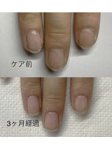 プティットミント(Putit Mint)/美爪育成ケア(１回お試し)