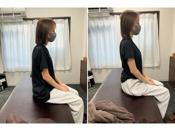恵比寿西口整体院/施術のビフォーアフター