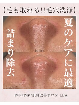 レア(Lea)/ザラ付き詰まり除去＊