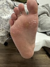 レタラ(Retar)/角質ケア¥3500