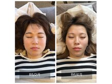 美容整体サロン プライム(Prime)の雰囲気（人気メニューの小顔のダイエットは圧倒的な変化を実感できます。）
