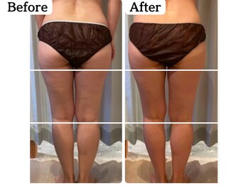 ムーロ(muro.)/Before After