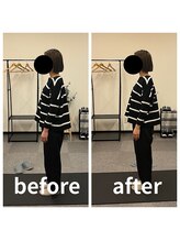 熊本カワル整体 JR上熊本駅院/ストレートネック、巻き肩