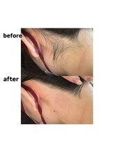 ミスターアンドミス 四ツ橋 堀江店(Mr.&Ms.)/レディースうなじ脱毛