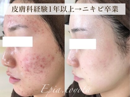 エピア 豊田店(Epia)の写真