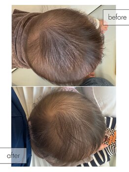 しん整骨院/子どもの頭の形整体