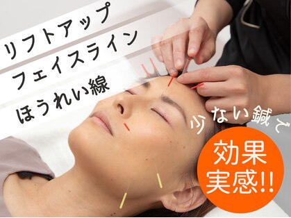 ともしび鍼灸整骨院の写真