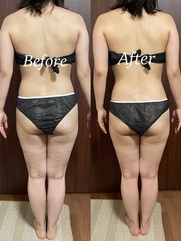 ヴィム(VIM)/ハイパーナイフビフォーアフター