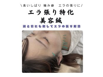 ハリナチュレ 那覇店(HARINATURE)/エラ張り特化美容鍼