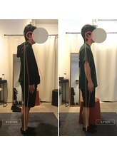 岡山整体 リソル(Resol)/姿勢改善ビフォーアフター
