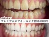 【超お得☆】ワンランク上の白さを実現☆プレミアムホワイトニング【4980円】