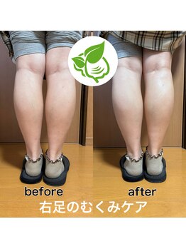 カイロプラクティック ネクサス/むくみ撃退☆