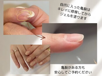 フェリーチェ 中目黒店(felice)/自爪の亀裂補強/フローター
