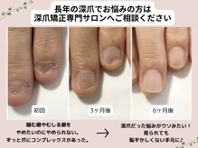 ネイルズシアム