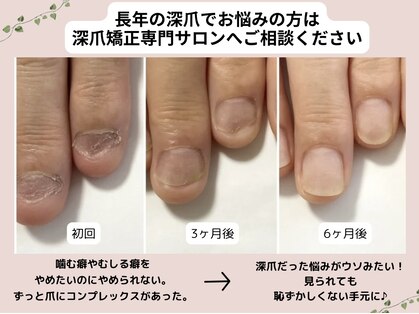 ネイルズシアムの写真