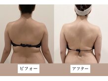 TMサロン とも寺の雰囲気（ガチガチ首肩＆お腹＆わき肉もスッキリ撃退！）