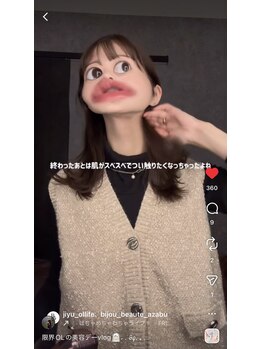 ビジュボーテ(Bijou Beaute)/インフルエンサーさん来院