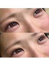 アルフォンス バイ ブリッジ(Alphonse by Bridge)/《似合わせカール》