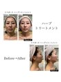 ラグーナ(Laguna)&nbsp;認定ハーバリストのみが施せる幹細胞ハーブで未来の理想肌へ