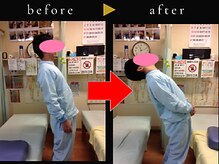 杉本接骨鍼灸院/若々しい背骨を取り戻す整体
