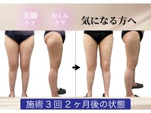 クオンタム(Quantum)の雰囲気（足・腕まわり・お腹まわりの気になる箇所をケアします♪）