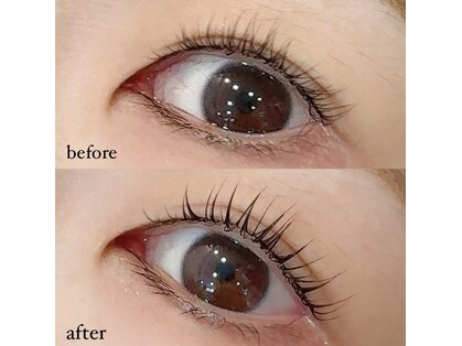 アレッタ ドナ 北千住店(ALETTA DONA)の写真