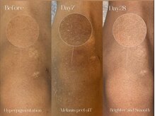 リュミエール デスポワール(Lumiere d'espoir)/ローマピンク