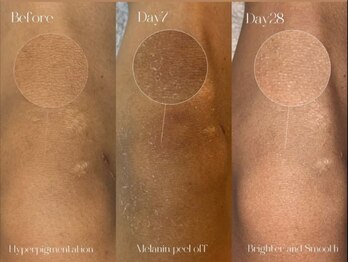 リュミエール デスポワール(Lumiere d'espoir)/ローマピンク