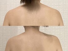 モナートドゥ(Monartdeux)/骨盤×オイルリンパマッサージ