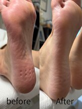 アイネイルサロン(i nail salon)/韓国式足裏角質ケア