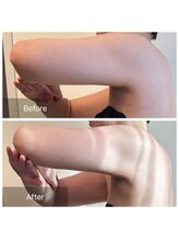 エヌア(nA)/2ヶ月プラン♪40代