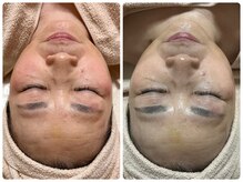 コア(Coeur)の雰囲気（次世代ラミネーションピーリング♪美肌/毛穴/くすみ/エイジング）