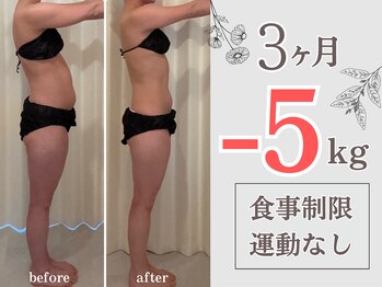 ヨサパーク 温美(YOSA PARK)の写真/3ヶ月でマイナス5kgも夢じゃない！？静かに座っているだけでカロリー消費◎