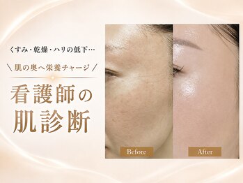 エン 橿原店(en)の写真/最近、肌がなんとなく冴えない…。くすみ・乾燥・ハリ不足に、看護師が必要な美肌ケアをご提案します。