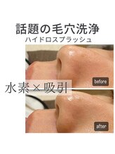 ビモアス(bimous)/話題の毛穴洗浄☆