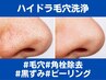 【ハイドラ毛穴洗浄】毛穴の黒ずみ＆角栓汚れごっそりキレイ★珪藻土パック付