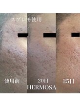 サロンドカメリア(salon de Camellia)/お悩みごとにホームケアをご提案