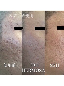 サロンドカメリア(salon de Camellia)/お悩みごとにホームケアをご提案