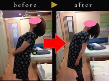 杉本接骨鍼灸院/若々しい背骨を取り戻す整体