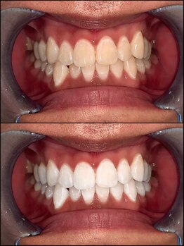 ライトビューティー 池袋店(LightBeauty)/症例写真