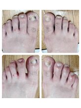 リゼランアンドコー 福島鎌田店(LIZERA&Co)/深爪さん！