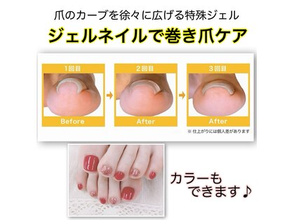 ミコ(.mico)の写真