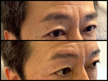 スリーピース(3Peace)/ストレートアーチ眉Before/After