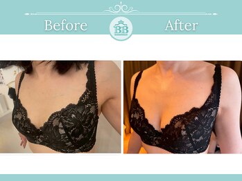 美人バスト 浜松店/◇ バストアップ &nbsp;BeforeAfter◇
