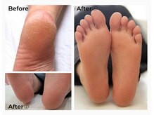 アイリス(iris)の雰囲気（【大人気！】”ふわっ”としたマシュマロフットに仕上げます◎）