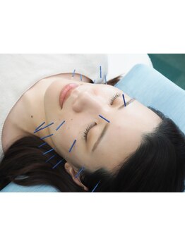 鍼灸施術を受けたい