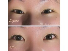 癒縁(ゆえん)/お目元の印象がガラッと変わる♪