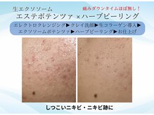 エイミー(Aimee)/お肌に負担なくケア！